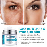 Dark Spot Remover for Face and Body, Dark Spot Corrector Cream, Dark Spot Corrector Cream for Age Spot, Blemish Spot, Melasma, Freckle, Sun Spots Remover & Blemish Reducer for Women Men